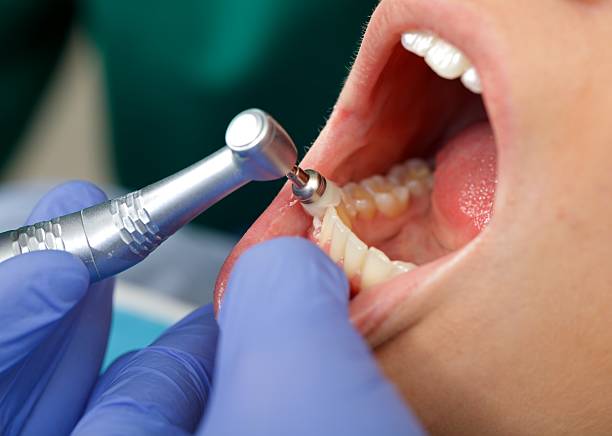 Best Dental Fillings (Composite and Amalgam)  in El Dorado Hills, CA